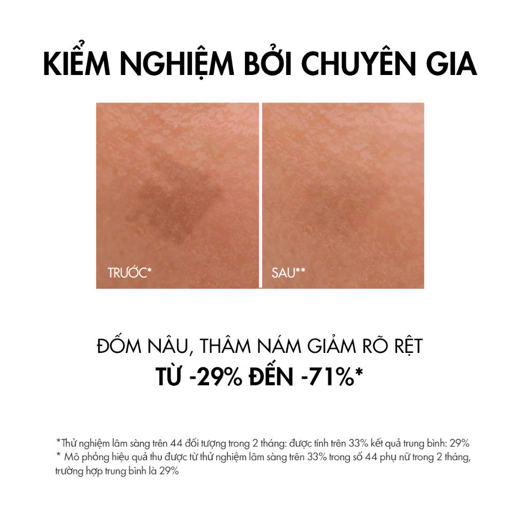 Ảnh Tinh chất giúp cải thiện & ngăn ngừa thâm nám đốm nâu Vichy Liftactiv B3 dark spots 30ml 2