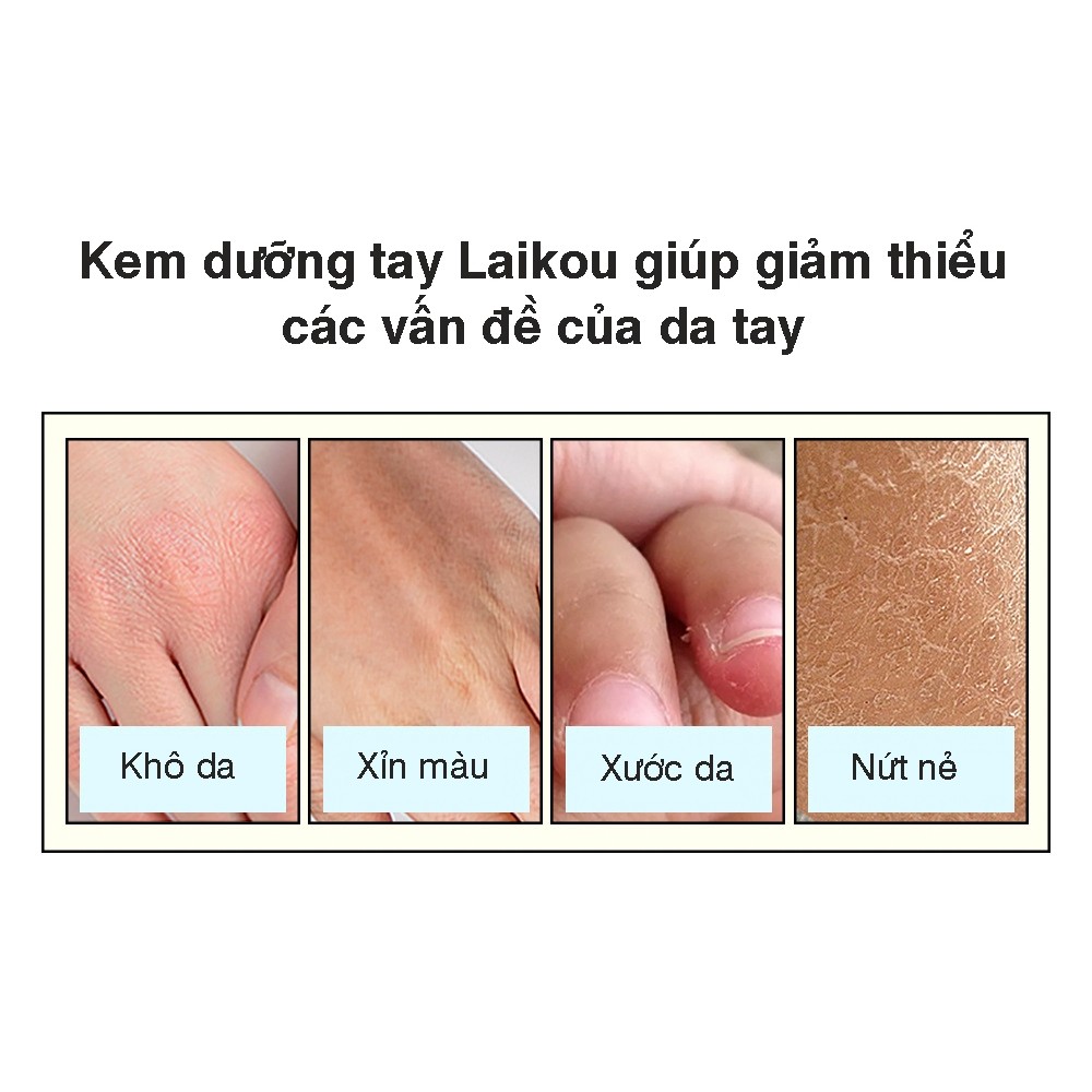Kem dưỡng da tay công nghệ Nhật Bản chăm sóc, dưỡng làm sáng phục hồi làn da thô ráp cao cấp 30g