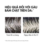 Bộ 2 Dầu gội sạch gàu Dercos VICHY 100% chỉ sau 1 lần gội dành cho da dầu ngứa SỐ1 Việt Nam chuyên gia khuyên dùng 200ml — ảnh 5