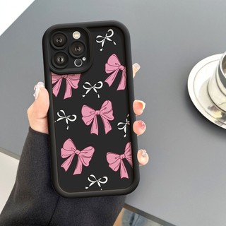 Ốp Lưng iPhone Camera Viền Cao Pink Bow Mềm Chống Sốc, Cao Cấp - iP 7/8/X/XS/XR/11/12/13/14/15/16/17/Plus/Air/Pro/Max