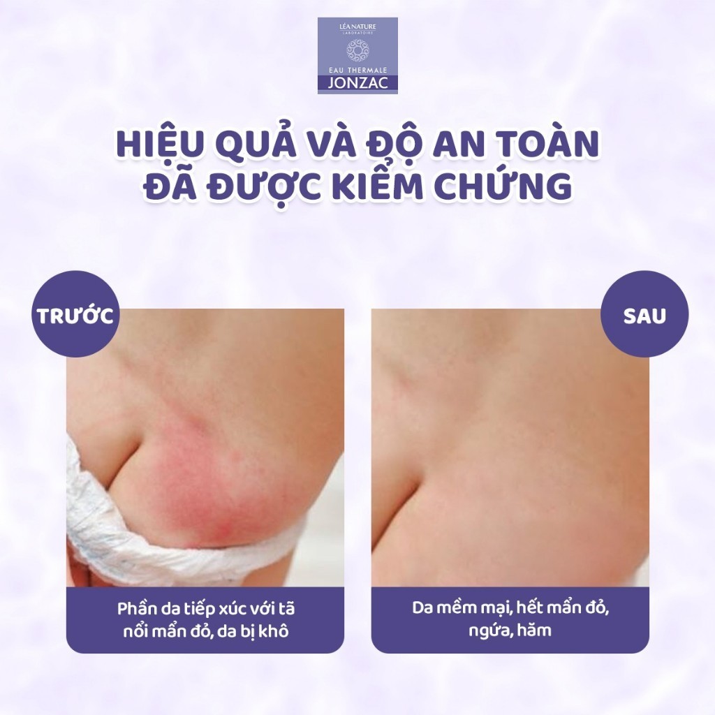 [JONZAC] Dung dịch vệ sinh chống hăm tã hữu cơ JONZAC - Giữ ẩm làm mềm nuôi dưỡng làn da bé