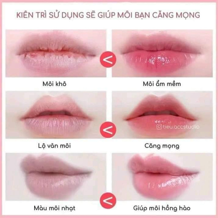 Dưỡng môi Vaseline Lip Therapy 20g son dưỡng