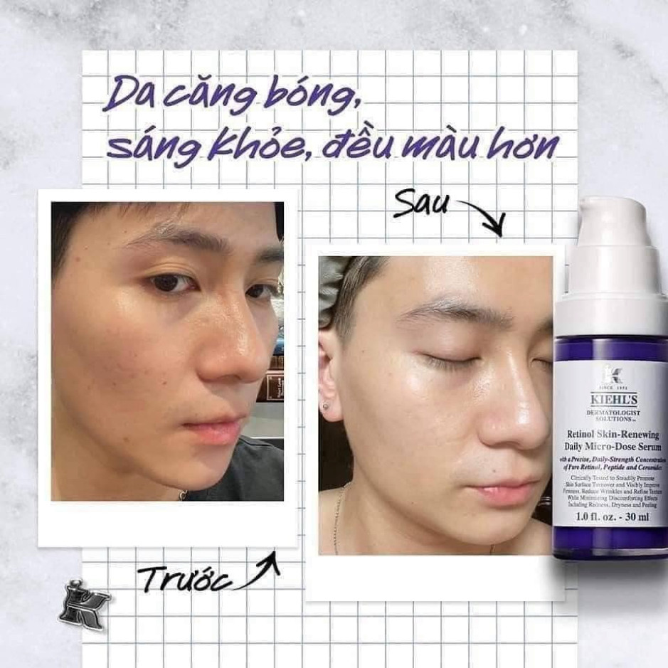 Kem Retinol K Micro Dose 50ml fullbox