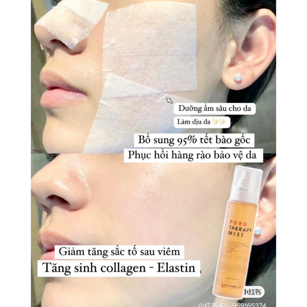 Xịt khoáng Kyung Lab PDRN Therapy Mist cấp ẩm, bổ sung dưỡng chất căng bóng da