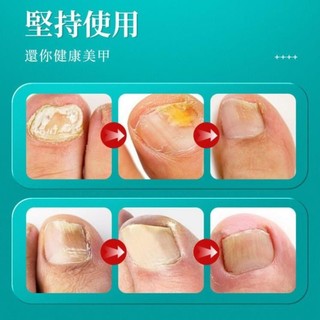 Xịt nấm móng tay chân nội địa Trung DIW 30ml  ngăn ngừa nấm móng dưỡng móng kháng khuẩn