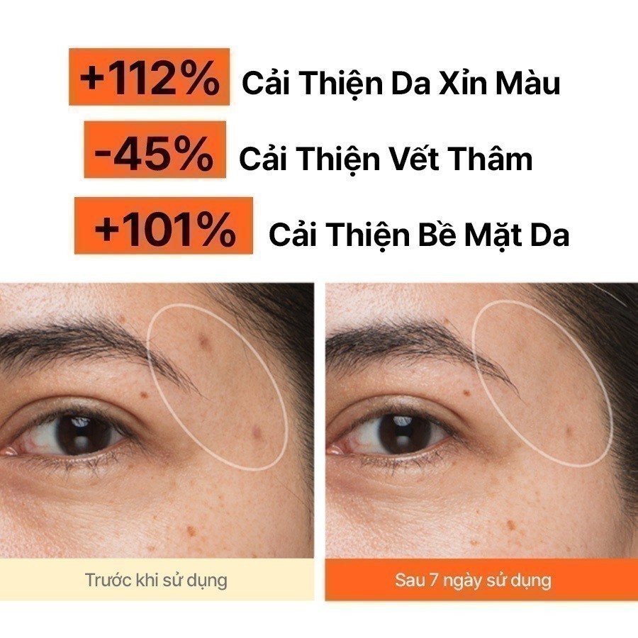 (Quà tặng không bán) Set 03 Tinh chất dưỡng sáng da Vitamin C Green Tea Enzyme Brightening Serum 7mlx3
