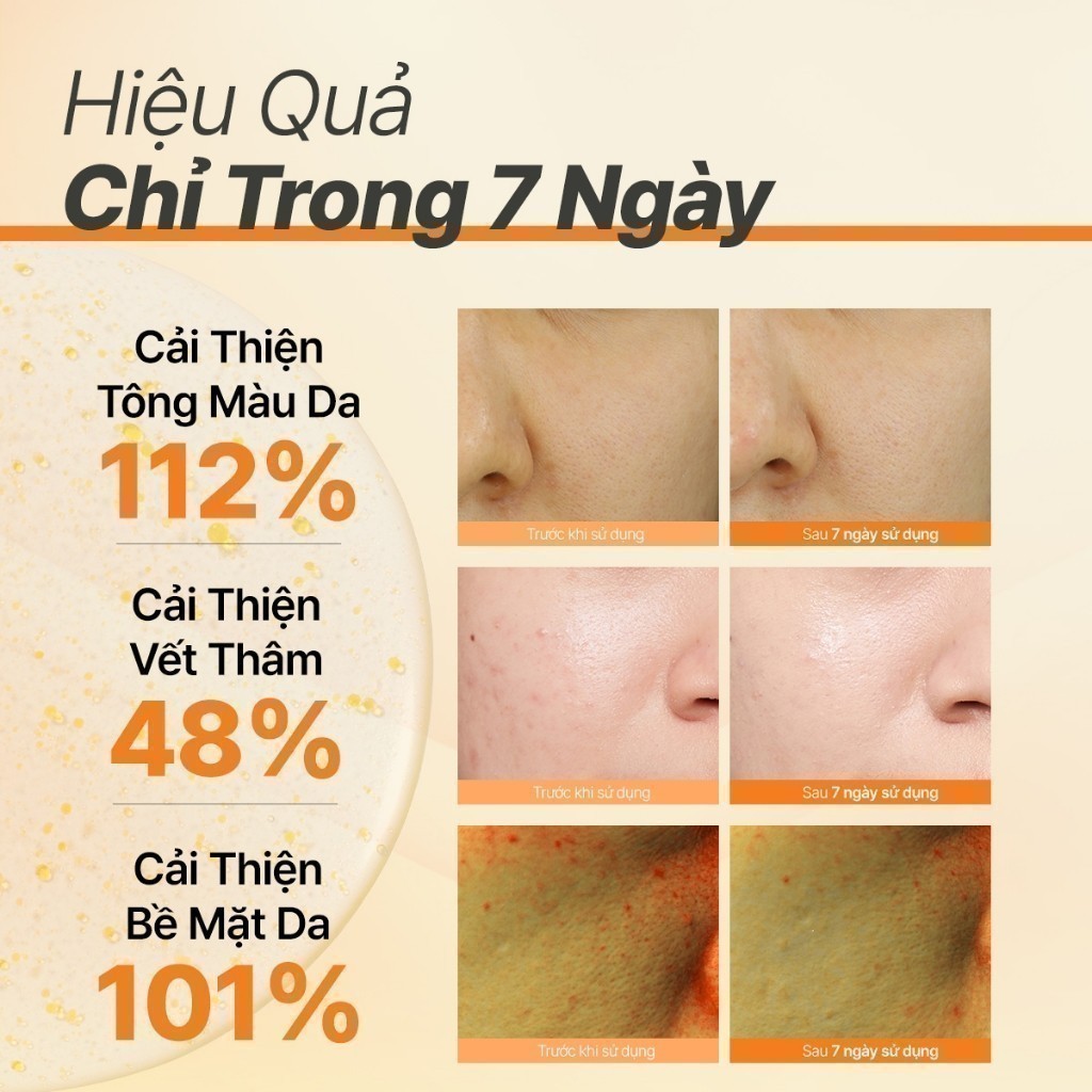 (Quà tặng không bán) Serum viên nang Vitamin C sáng da INNISFREE Green Tea Enzyme Brightening Serum 1ml