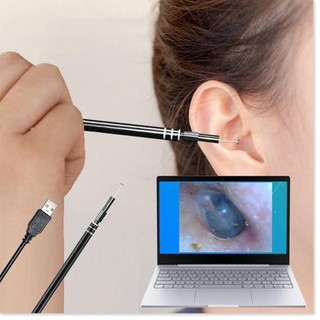 Dụng Cụ Lấy Ráy Tai Camera Chính Hãng 3 trong 1 có đèn LED, Nội Soi Tai Mũi Họng ( DÒNG CHO ANDROI )