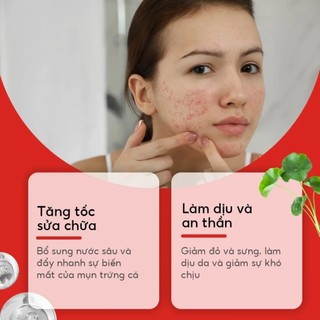 MIẾNG DÁN MỤN HYDROCOLLOID NGÔI SAO COMBO 2 GÓI 80 MIẾNG | ACNE PATCH SIÊU MỎNG CHE PHỦ MỤN BÁM CHẮC