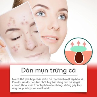 MIẾNG DÁN MỤN HYDROCOLLOID NGÔI SAO COMBO 2 GÓI 80 MIẾNG | ACNE PATCH SIÊU MỎNG CHE PHỦ MỤN BÁM CHẮC