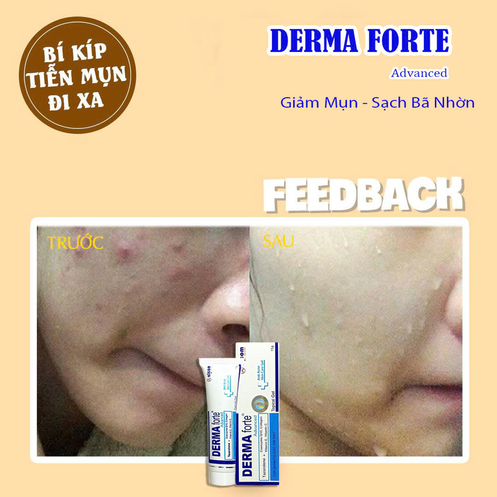 Kem Chấm Mụn Derma Forte Advanced 15g Chính Hãng – Giảm Sưng Mụn, Hỗ Trợ Mờ Thâm