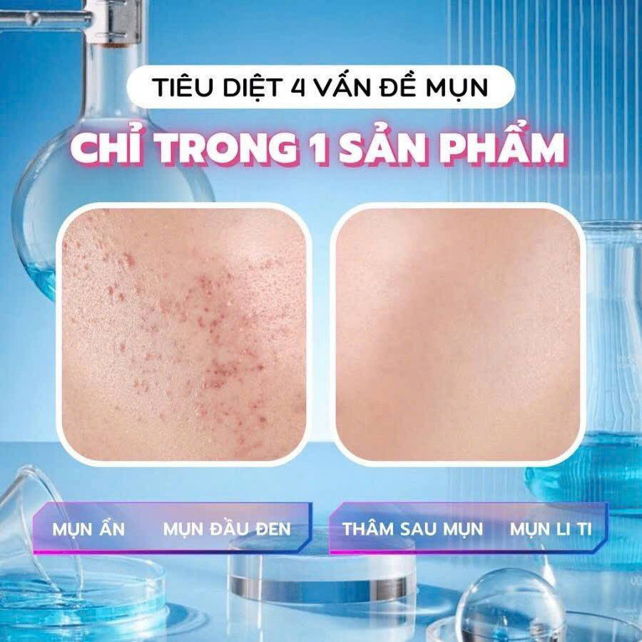 Azemix Gel 20g Chính Hãng – Mờ Thâm Sáng Da, Giảm Dầu Nhờn, Phục Hồi Da Nhạy Cảm