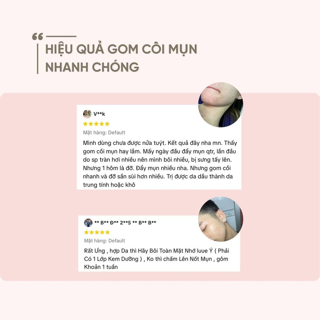Azemix Gel 20g Chính Hãng – Mờ Thâm Sáng Da, Giảm Dầu Nhờn, Phục Hồi Da Nhạy Cảm