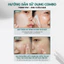 Set Toner Pad 60 miếng và Kem chấm mụn Centella Spot 15ml P.CALM, HỖ TRỢ GIẢM MỤN