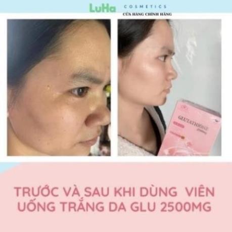 glutathione for skin wellness Amazon.com: Orinthalixium Liposomal Glutathione Gummies 1000MG - Sugar Free  Reduced L-Glutathione with Vitamin C & Vegan Collagen - Antioxidant & Skin  Wellness
