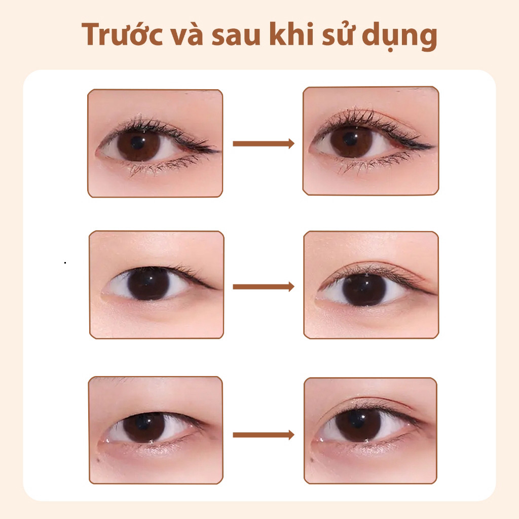 Dán Mí AKF Trong Suốt – Miếng Dán Kích Mí Tàng Hình, Thoáng Khí, Chống Mồ Hôi, Bám Dính Tự Nhiên