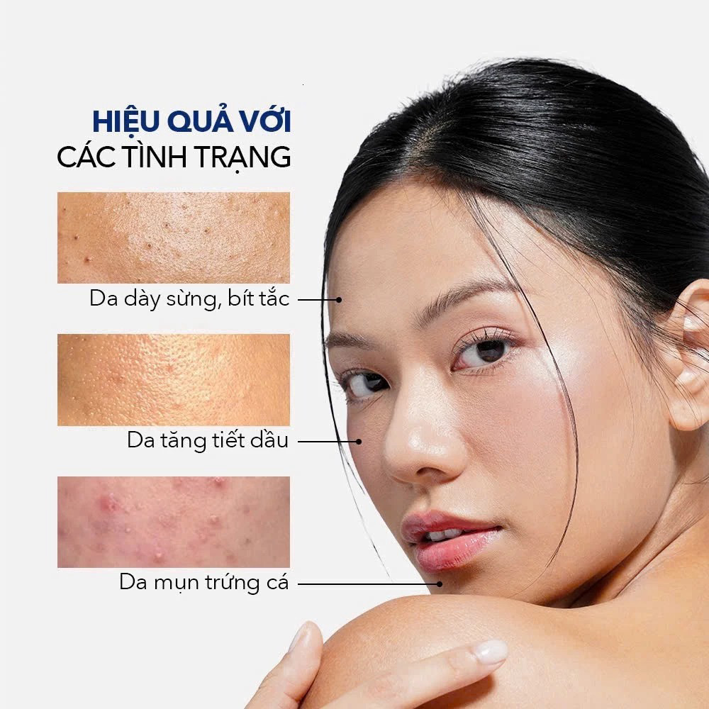 Dung Dịch 2% BHA Cho Da Dầu Mụn IMAGE Skincare CLEAR CELL Clarifying  Salicylic Tonic 118ml | Lâm Bùi Cosmetics | Shopee Việt Nam