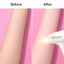 Máy Triệt Lông Lạnh Sapphire ELYSKIN MX1 Cao Cấp, 9 Cấp Độ Công Nghệ IPL Đèn Thạch Anh Trẻ Hóa Da - BH 12 Tháng