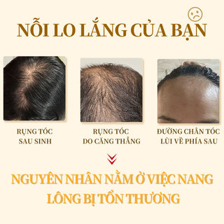 Dầu gội chống rụng tóc Dầu gội gừng lá trắc bách & gừng kích mọc tóc CNMOFAXIN 480ml