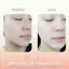 Sữa rửa mặt giảm mụn, chống viêm, dịu nhẹ H.T Solution Pack Cleansing Foam, 120ml
