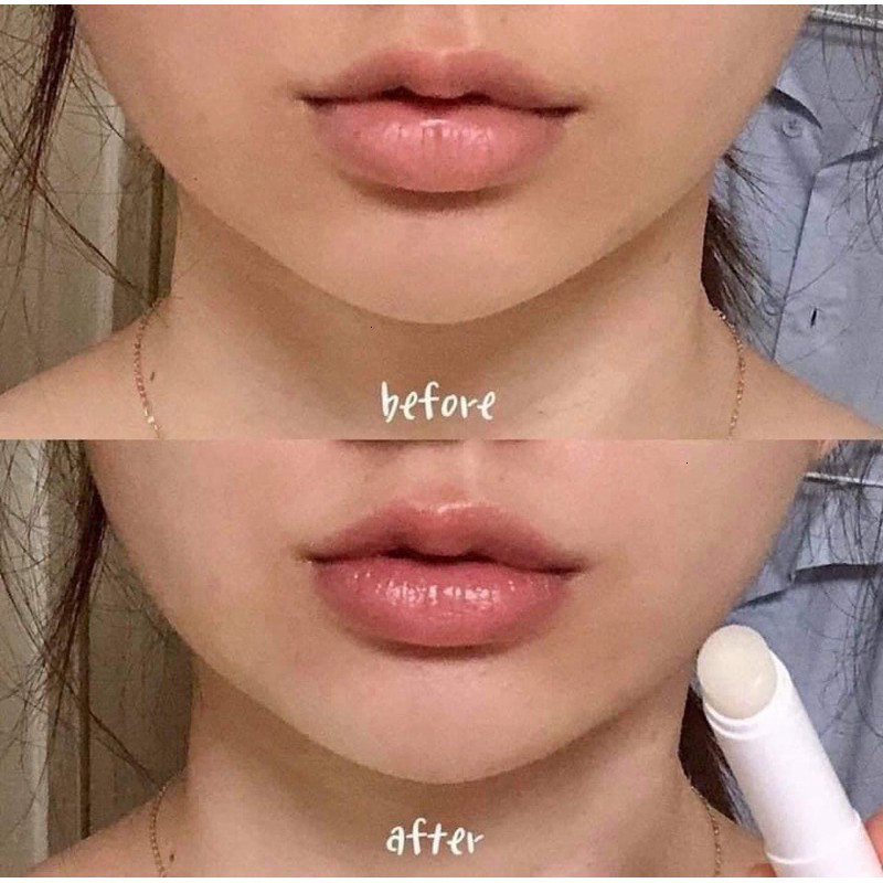 Son dưỡng môi bioderm dưỡng ẩm làm mềm môi