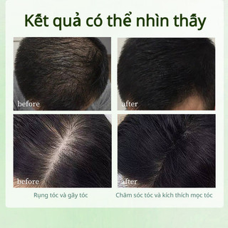 Xà bông gội đầu Tam Giác, kiểm soát dầu và gàu, làm sạch dịu nhẹ, ngăn ngừa rụng tóc hiệu quả, phục hồi tóc hư tổn.