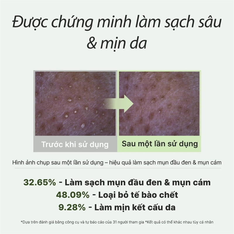 Sữa rửa mặt Arencia Mochi gạo xanh 120g | Arencia Mochi gạo Hyssop Royal Blue  | Arencia Mochi gạo Royal Rosehip