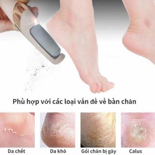 Máy Chà Gót Chân Điện Mini 2 Tốc Độ Có Đèn Led – Làm Mịn Gót Chân Nứt Nẻ, Sần Sùi Nhanh Chóng