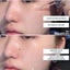 Gói Tinh Chất Peel Da CNP Rx Skin Rejuvenating Intensive Peel Hỗ Trợ Sáng Da Mờ Thâm 2ml