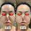 Gói Tinh Chất Peel Da CNP Rx Skin Rejuvenating Intensive Peel Hỗ Trợ Sáng Da Mờ Thâm 2ml