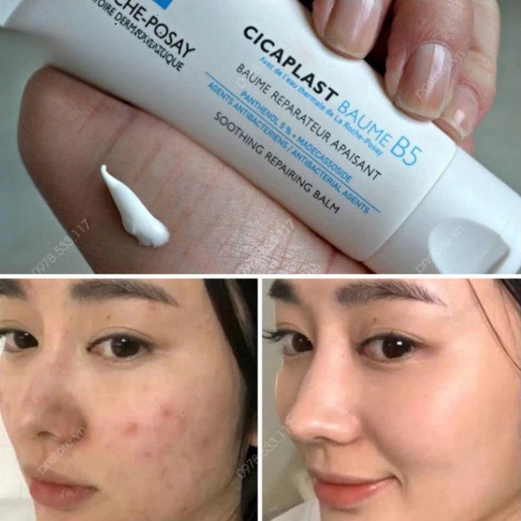 Kem Dưỡng La Roche-Posay Cicaplast Baume B5 (40ml/100ml) - Phục Hồi, Làm Dịu Da Tổn Thương & Giảm Kích Ứng