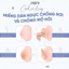 Miếng Dán Ngực Tự Thân Silicone Jary Nipple Covers Chống Rớt Chống Mồ Hôi