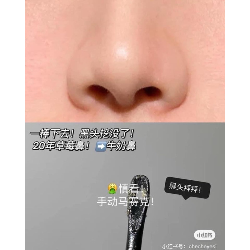 Miếng đẩy mụn cám, mụn đầu đen Ciracle Good Bye Black Head