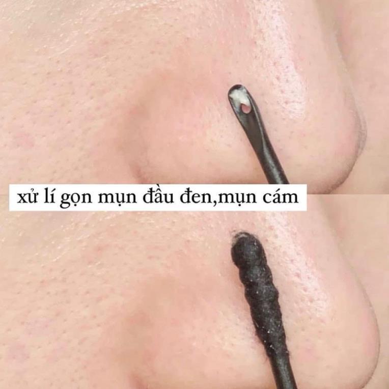 Miếng đẩy mụn cám, mụn đầu đen Ciracle Good Bye Black Head