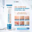 Gel Chấm Mụn Luciderm Blemish Control Gel 20g - Giúp Giảm Mụn , Mờ Thâm Sau Mụn , Hỗ Trợ Ngăn Ngừa mụn