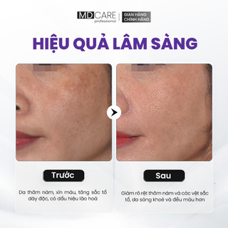 Kem Dưỡng Da Trắng Sáng Thế Hệ Mới MD CARE 30ml A.R.T BRIGHTENING COMPLEX
