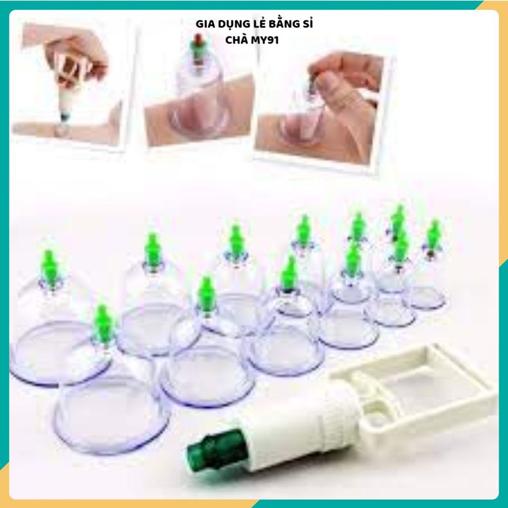 GIÁC HƠI HÚT CHÂN KHÔNG CAO CẤP - 12 Ly Bền Đẹp, Hỗ Trợ Massage Cơ Thể
