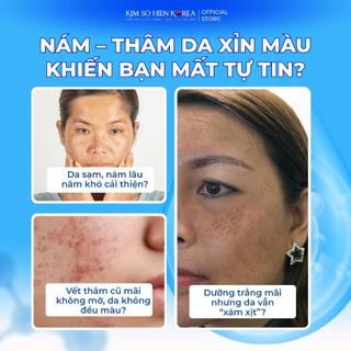 KEM NMN MELASMA EXOSOME - BAN ĐÊM 50ML(MYHAELYN NMN EXO MELASMA CLEAR NIGHT CREAM-8809186779647)