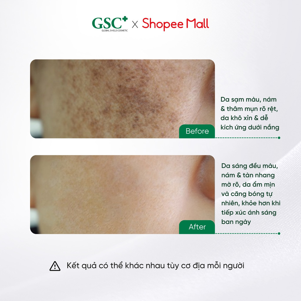 Serum Trắng Da, Mờ Thâm Nám BAN NGÀY GSC Mela Bright Day Serum 30 ML Hỗ Trợ Sáng Da Chuyên Sâu - GC097A