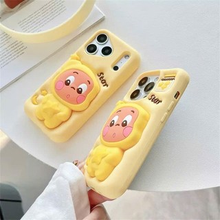 Ốp lưng iphone Twinkle Boy Có Giá Đỡ 6plus/7plus/8plus/x/xs/xsmax/11/12/13/14/15/16/17/air/pro/plus/promax RABBI SLC