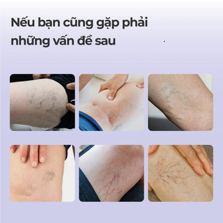 Kreain Nature Gel Giảm áp lực tĩnh mạch chân, giảm sưng, hỗ trợ tuần hoàn