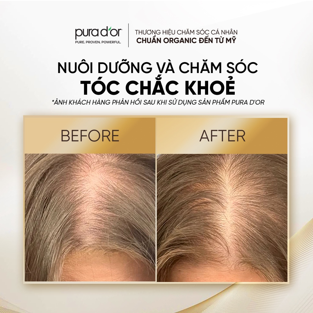 Mô tả Combo Dầu Gội Dầu Xả Hỗ Trợ Giảm Rụng Tóc, Hỗ Trợ Mọc Tóc Biotin Gold Label PURA D'OR 236ML - 4