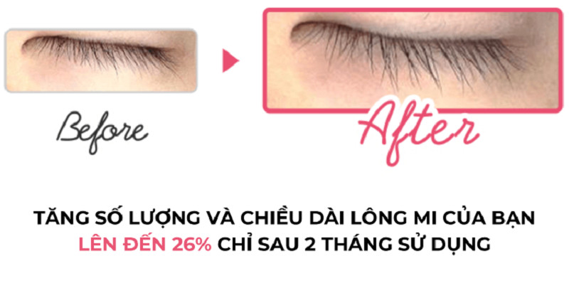 Mô tả Tinh Chất Dưỡng Mi, Giữ Cong Mi, Chống Thấm Nước Club Suppin Nhật Bản Hộp 6,6ML - 3