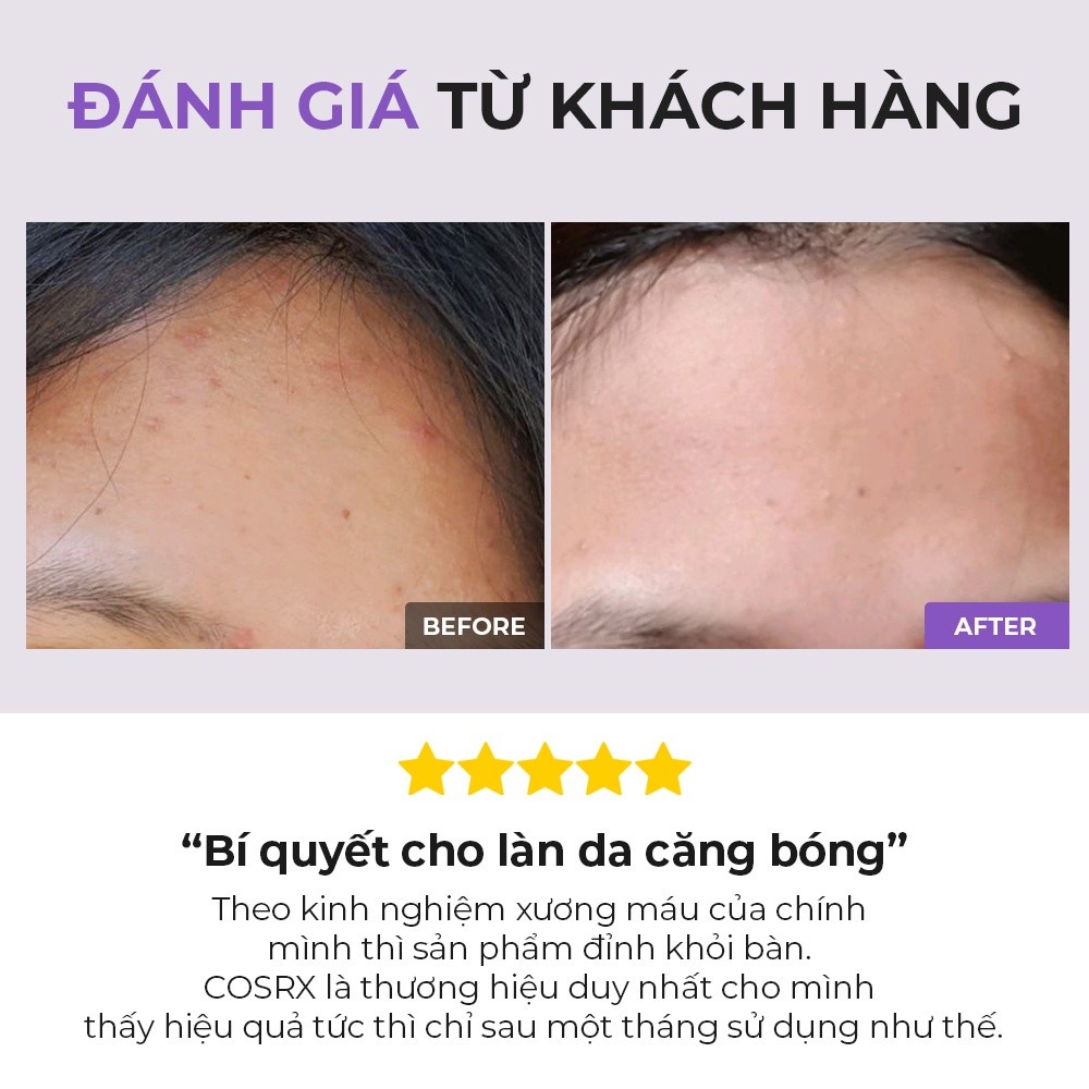 Mô tả Nước hoa hồng COSRX chứa AHA/ BHA tẩy tế bào chết làm sáng da giảm mụn hiệu quả dung tích 50ml/100ml/150ml - 3