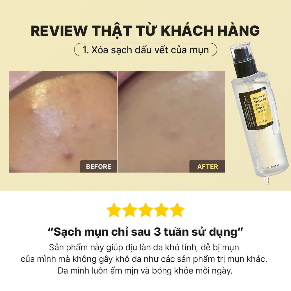 Mô tả Set serum ốc sên 96 mucin 100ml + kem dưỡng ẩm COSRX tái tạo phục hồi da chiết xuất 92% dịch ốc sên 100g - 7