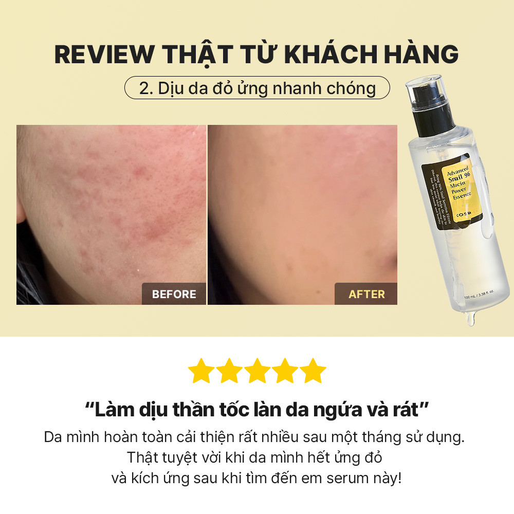 Mô tả Set serum ốc sên 96 mucin 100ml + kem dưỡng ẩm COSRX tái tạo phục hồi da chiết xuất 92% dịch ốc sên 100g - 8