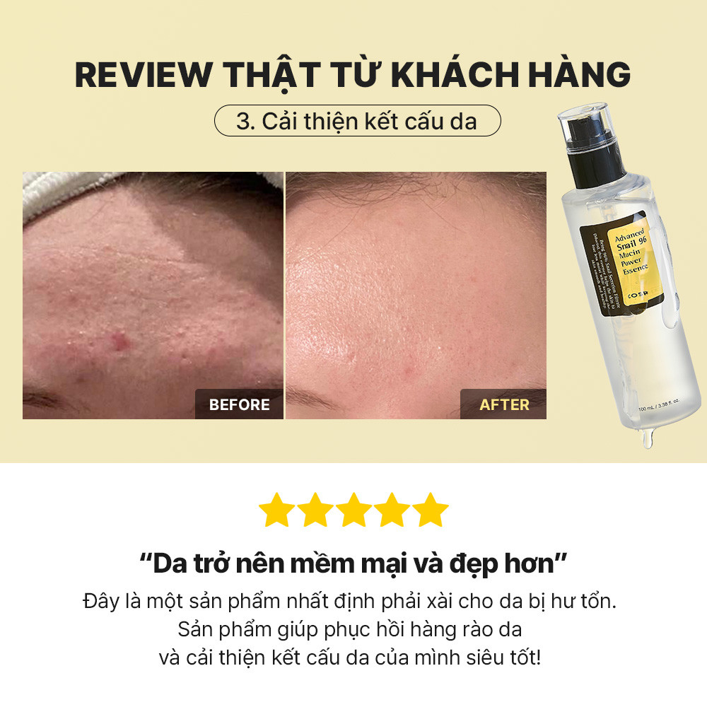 Mô tả Set serum ốc sên 96 mucin 100ml + kem dưỡng ẩm COSRX tái tạo phục hồi da chiết xuất 92% dịch ốc sên 100g - 9