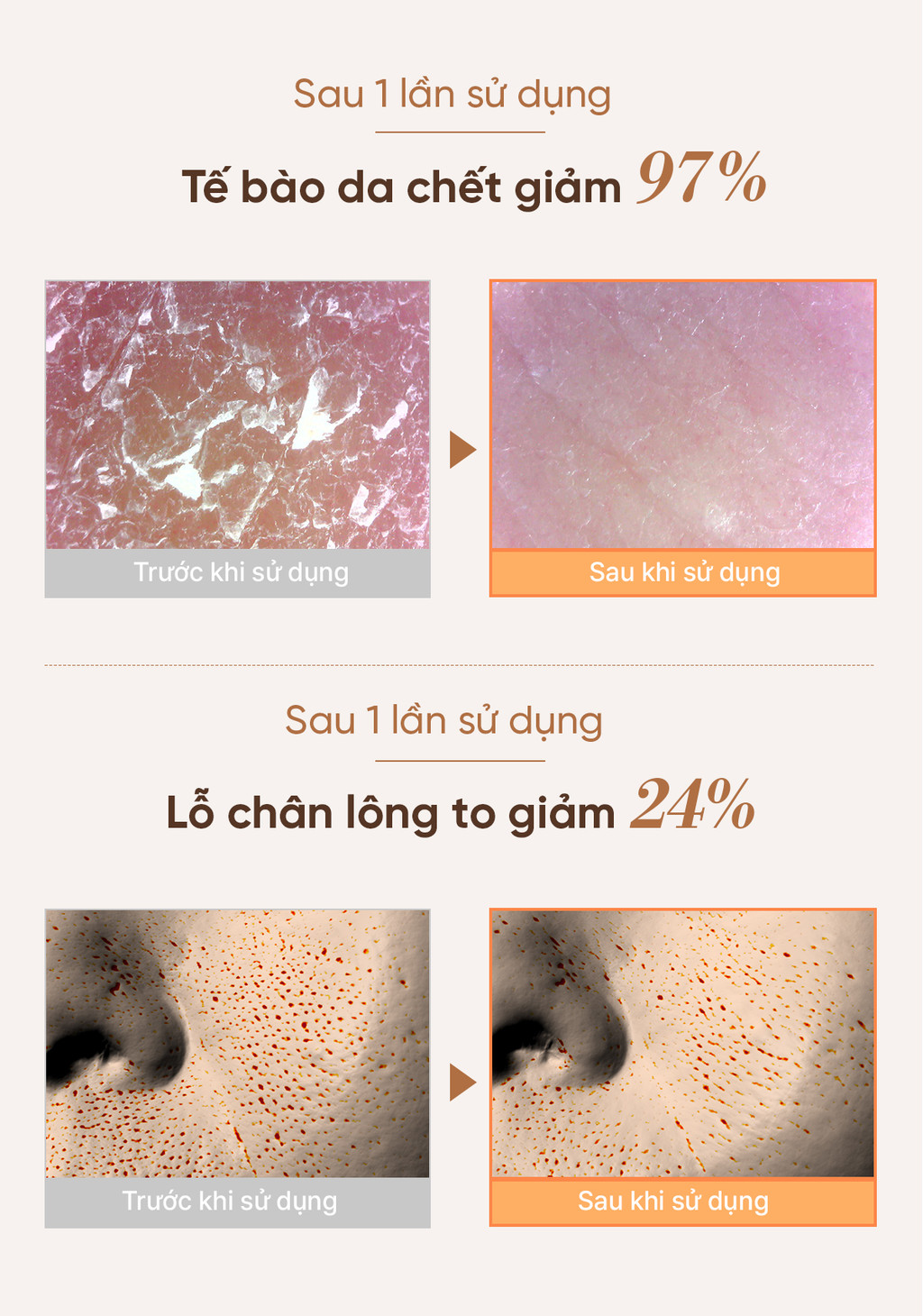 Bọt sữa rửa mặt THE WHOO