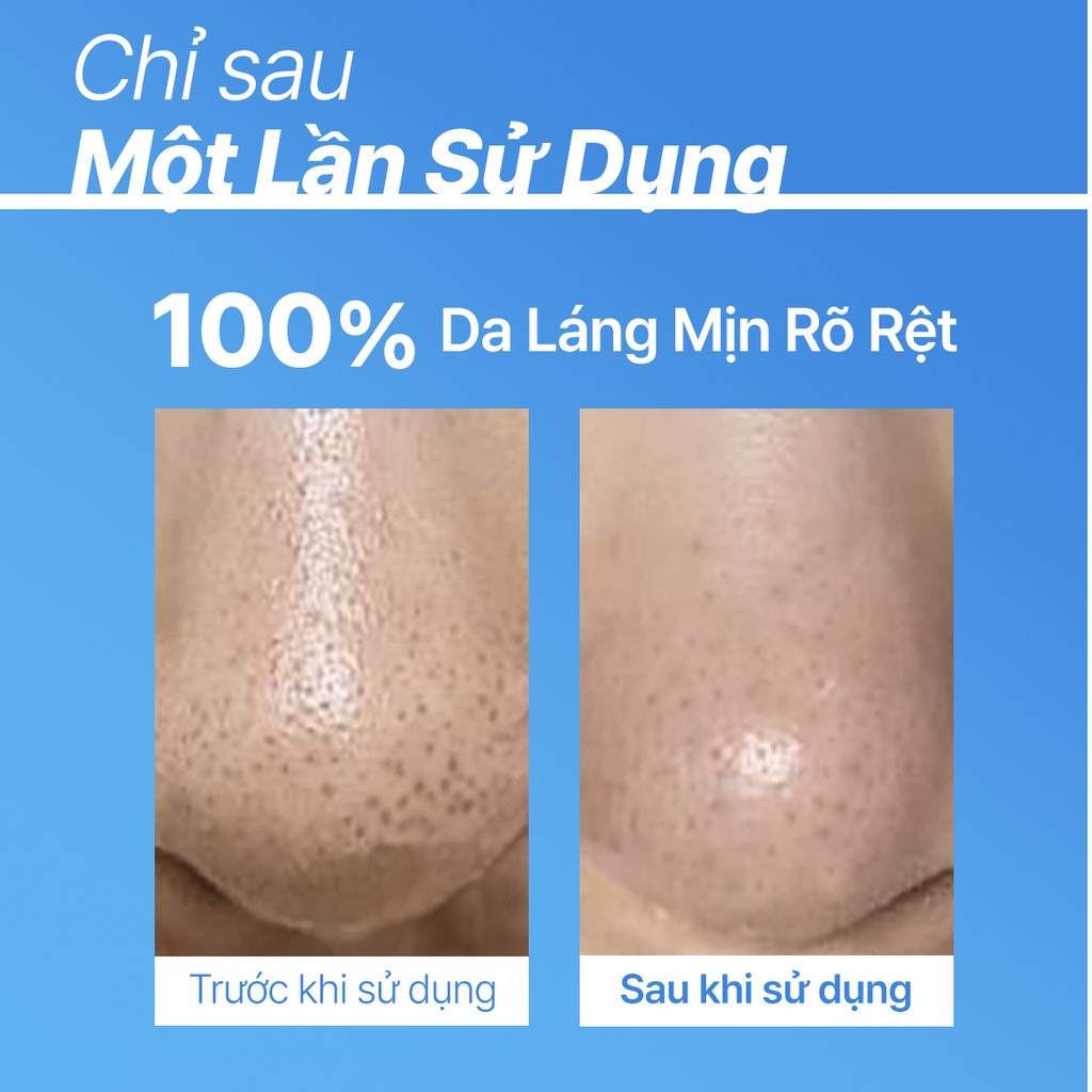 Mô tả Serum kiểm soát dầu mụn cho da láng mịn INNISFREE Retinol Cica Repair Ampoule 30mL - 4