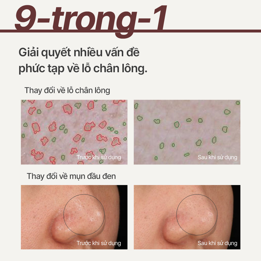 Mô tả Siêu mặt nạ đất sét tro núi lửa giảm nhờn, thu nhỏ lỗ chân lông INNISFREE Super Volcanic Pore Clay Mask 100ml - 4